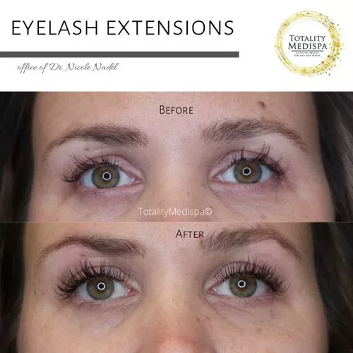 Lashes Extensions and Lift/Tint Before and After Photo by Totality Medispa in Charleston, SC