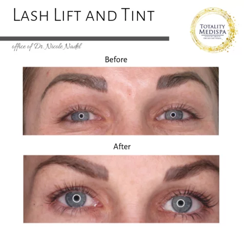 Lashes Extensions and Lift/Tint Before and After Photo by Totality Medispa in Charleston, SC