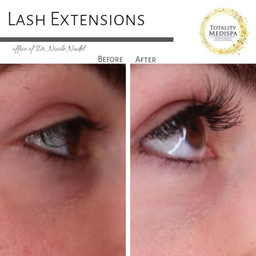 Lashes Extensions and Lift/Tint Before and After Photo by Totality Medispa in Charleston, SC
