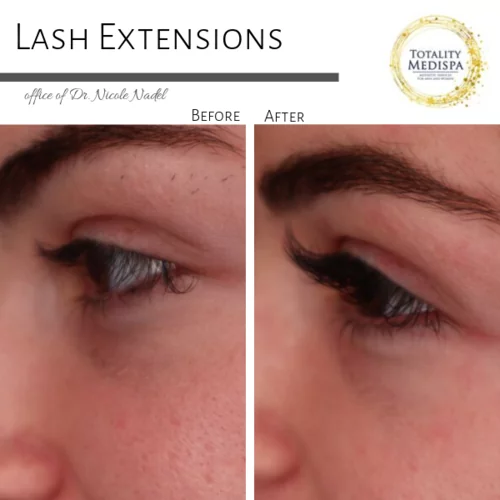 Lashes Extensions and Lift/Tint Before and After Photo by Totality Medispa in Charleston, SC