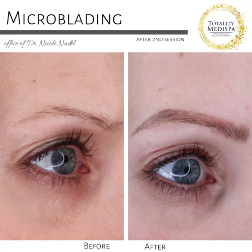 Microblading Before and After Photo by Totality Medispa in Charleston, SC