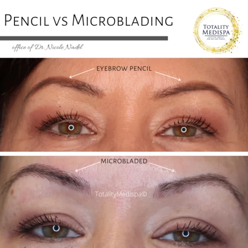 Microblading Before and After Photo by Totality Medispa in Charleston, SC
