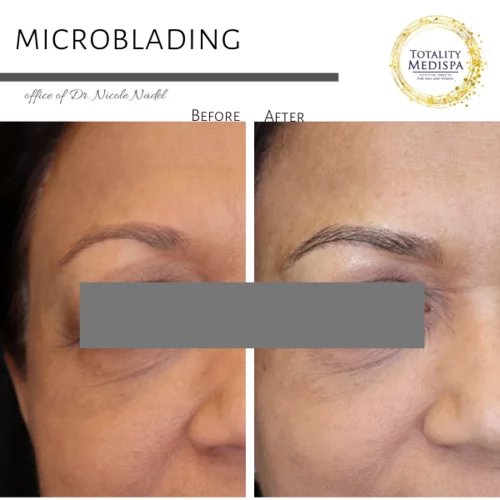 Microblading Before and After Photo by Totality Medispa in Charleston, SC