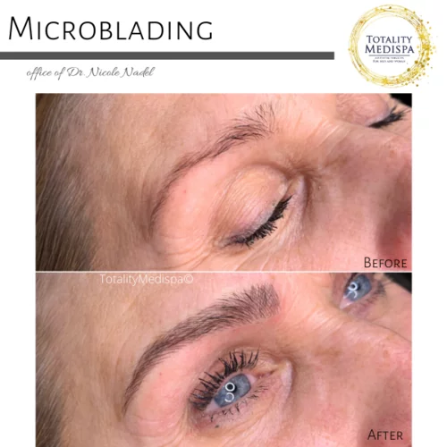 Microblading Before and After Photo by Totality Medispa in Charleston, SC