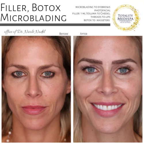 Microblading Before and After Photo by Totality Medispa in Charleston, SC