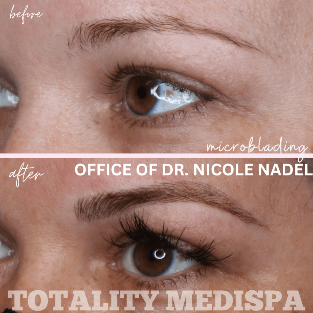 Microblading Before and After Photo by Totality Medispa in Charleston, SC